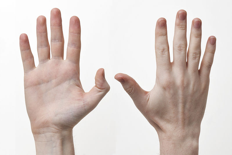Best and affordable Dupuytren's contracture surgery in aberdeen, uk by Dr Jamil Ahmed